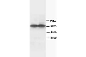 Western Blotting (WB) image for anti-Tyrosine Hydroxylase (TH) antibody (ABIN1109422) (Tyrosine Hydroxylase Antikörper)
