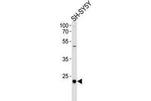 Western Blotting (WB) image for anti-CCAAT/enhancer Binding Protein (C/EBP), delta (CEBPD) (AA 176-205), (C-Term) antibody (ABIN951461)