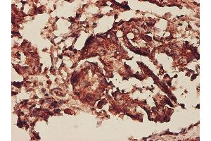 Immunostaining (ISt) image for anti-Prohibitin (PHB) (AA 1-272) antibody (ABIN562206)