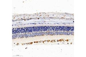 Immunohistochemistry of paraffin embedded rat eye using NACAD (ABIN7074756) at dilution of 1:1000 (300x lens)