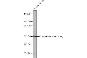 Western blot analysis of extracts of Mouse serum, using C-Reactive Protein (C-Reactive Protein (CRP)) antibody (ABIN7265972) at 1:1000 dilution. (CRP Antikörper)