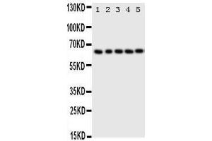Anti-p63 antibody, Western blotting Lane 1: HELA Cell Lysate Lane 2: SMMC Cell Lysate Lane 3: COLO320 Cell Lysate Lane 4: A549 Cell Lysate Lane 5: SGC Cell Lysate (p63 Antikörper  (C-Term))