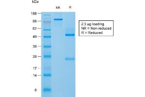 SDS-PAGE Analysis Purified Filaggrin Rabbit Recombinant Monoclonal Antibody (FLG/1957R). (Rekombinanter Filaggrin Antikörper  (AA 198-288))