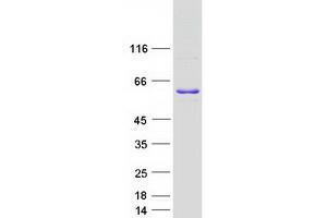 Validation with Western Blot (WBP4 Protein (Myc-DYKDDDDK Tag))