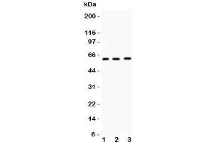 Western blot testing of FMO5 antibody and mouse samples (50ug/lane) 1: liver;  2: testis;  3: spleen tissue lysate. (FMO5 Antikörper  (N-Term))