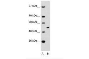 Image no. 2 for anti-Amyloid beta (A4) Precursor Protein-Binding, Family A, Member 1 (APBA1) (AA 41-90) antibody (ABIN6736687) (APBA1 Antikörper  (AA 41-90))