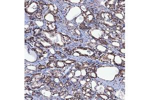 IHC analysis of SH2D4A using anti-SH2D4A antibody (ABIN7601695).