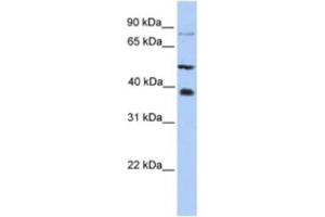 Western Blotting (WB) image for anti-Methyltransferase Like 2B (METTL2B) antibody (ABIN2463220)