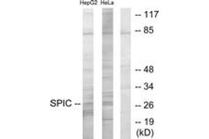 Western blot analysis of extracts from HepG2/HeLa cells, using SPIC Antibody. (SPIC Antikörper  (AA 131-180))