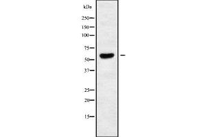 Western blot analysis of TIGD2 using K562 whole cell lysates (TIGD2 Antikörper)