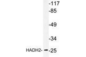 Western blot analysis of HADH2 antibody in extracts from LOVO cells. (HSD17B10 Antikörper)