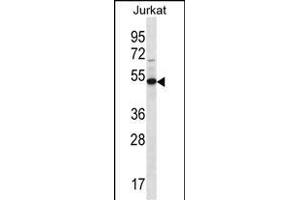 FA8A1 Antibody (N-term) (ABIN656718 and ABIN2845946) western blot analysis in Jurkat cell line lysates (35 μg/lane). (FAM8A1 Antikörper  (N-Term))