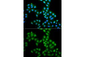 Immunofluorescence analysis of A549 cells using SAMHD1 antibody. (SAMHD1 Antikörper)