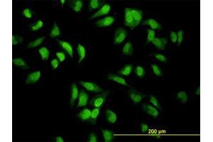 Image no. 1 for anti-Eukaryotic Translation Initiation Factor 2-alpha Kinase 2 (EIF2AK2) (AA 1-101) antibody (ABIN598900) (EIF2AK2 Antikörper  (AA 1-101))