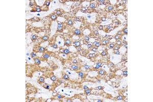 Immunohistochemistry (IHC) image for anti-MIT, Microtubule Interacting and Transport, Domain Containing 1 (MITD1) antibody (ABIN7268548)