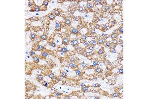 Immunohistochemistry of paraffin-embedded Human liver using MITD1 Rabbit pAb (ABIN7268548) at dilution of 1:100 (40x lens). (MITD1 Antikörper)