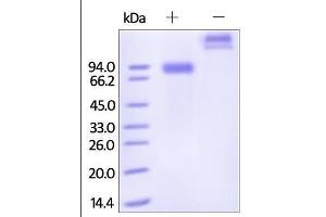 Human Siglec-6, Fc Tag on SDS-PAGE under reducing (R) and no-reducing (NR) conditions.