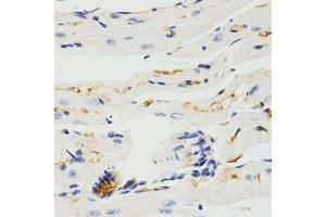 Immunohistochemistry (IHC) image for anti-TNF Receptor-Associated Factor 7 (TRAF7) antibody (ABIN3023478) (TRAF7 Antikörper)