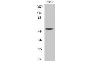 Western Blotting (WB) image for anti-CaM Kinase-Like Vesicle-Associated (CAMKV) (Internal Region) antibody (ABIN3183643)