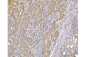IHC analysis of SND1 using anti-SND1 antibody (ABIN7600525). (SND1 Antikörper  (AA 20-204))