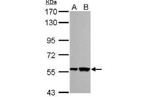 WB Image RBMY1A1 antibody detects RBMY1A1 protein by Western blot analysis. (RBMY1A1 Antikörper)