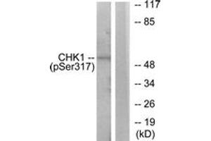 Western blot analysis of extracts from MCF7 cells, using Chk1 (Phospho-Ser317) Antibody. (CHEK1 Antikörper  (pSer317))
