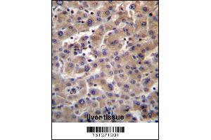 GUSB Antibody immunohistochemistry analysis in formalin fixed and paraffin embedded human liver tissue followed by peroxidase conjugation of the secondary antibody and DAB staining. (Glucuronidase beta Antikörper  (C-Term))