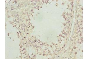 Immunohistochemistry of paraffin-embedded human testis tissue using ABIN7146719 at dilution of 1:100 (CA3 Antikörper  (AA 2-260))