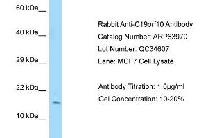 Western Blotting (WB) image for anti-Chromosome 19 Open Reading Frame 10 (C19orf10) (N-Term) antibody (ABIN2789685) (C19orf10 Antikörper  (N-Term))