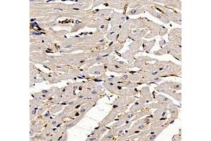 Immunohistochemistry of paraffin embedded rat heart using ANXA3 (ABIN7073065) at dilution of 1: 300 (400x lens) (Annexin A3 Antikörper)
