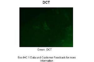 Sample Type :  Zebrafish embryo section  Primary Antibody Dilution :  1:50  Secondary Antibody :  Anti-rabbit-Alexa Fluor 488  Secondary Antibody Dilution :  1:500  Color/Signal Descriptions :  Green: DCT  Gene Name :  Dct  Submitted by :  Anonymous (DCT Antikörper  (Middle Region))