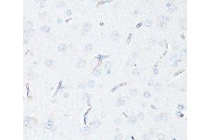 Immunohistochemistry of paraffin-embedded Rat brain endothelial cells using P Glycoprotein Polyclonal Antibody at dilution of 1:100 (40x lens). (P-Glycoprotein Antikörper)