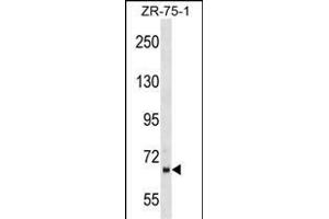 WD1 Antibody (Center) (ABIN1538147 and ABIN2849315) western blot analysis in ZR-75-1 cell line lysates (35 μg/lane). (PPWD1 Antikörper  (AA 236-262))