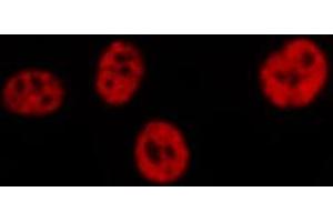 ABIN6267309 staining HeLa by IF/ICC. (C-JUN Antikörper  (pSer73))