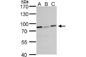 WB Image DDX3 antibody detects DDX3 protein by Western blot analysis.