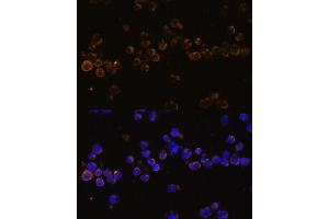 Immunofluorescence analysis of Jurkat cells using KLRC4 Polyclonal Antibody (ABIN7268115) at dilution of 1:100 (40x lens). (KLRC4 Antikörper  (AA 1-55))