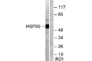 Western blot analysis of extracts from COLO205 cells, using HSP60 antibody (#C0233). (HSPD1 Antikörper)