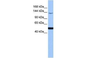 MAP3K1 antibody used at 1 ug/ml to detect target protein. (MAP3K1 Antikörper  (C-Term))