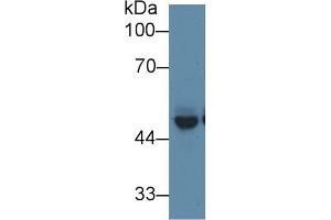 Western blot analysis of Mouse Cerebrum lysate, using Mouse PICK1 Antibody (1 µg/ml) and HRP-conjugated Goat Anti-Rabbit antibody (