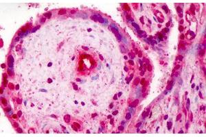 Human Placenta: Formalin-Fixed, Paraffin-Embedded (FFPE) (RBX1 Antikörper  (C-Term))