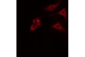 ABIN6274793 staining HT29 cells by IF/ICC. (ABHD8 Antikörper  (Internal Region))