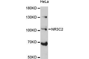 Western blot analysis of extracts of HeLa cells, using NR3C2 antibody (ABIN5971700) at 1:3000 dilution.