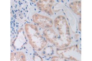 Used in DAB staining on fromalin fixed paraffin- embedded Kidney tissue (PTPN7 Antikörper  (AA 52-314))