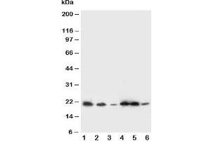 Western blot testing of SSR3 antibody and Lane 1:  rat liver;  2: rat spleen; and human samples 3: A431;  4: HeLa;  5: U87;  6: SMMC-7721 cell lysate. (SSR3 Antikörper  (AA 8-23))