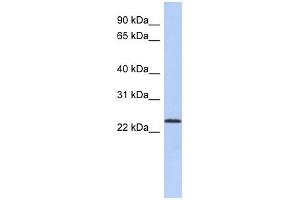 ULBP1 antibody used at 1 ug/ml to detect target protein.