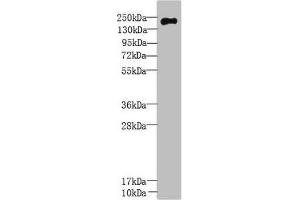 Western Blot All lanes: UBR2 antibody at 3 μg/mL + Mouse liver tissue Secondary Goat polyclonal to rabbit IgG at 1/10000 dilution Predicted band size: 201, 50, 67 kDa Observed band size: 201 kDa (UBR2 Antikörper  (AA 101-439))