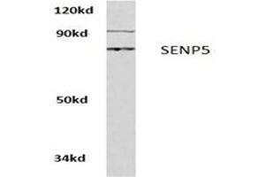 Image no. 1 for anti-SUMO1/sentrin Specific Peptidase 5 (SENP5) antibody (ABIN271958) (SENP5 Antikörper)