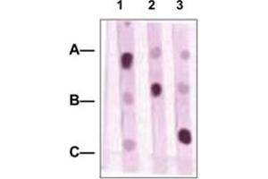 Dot Blot : 1 ug peptides was blotted onto NC membrane. (Oct-2 Antikörper  (C-Term))