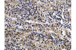 IHC analysis of CEP250 using anti-CEP250 antibody (ABIN7602053). (CEP250 Antikörper  (AA 563-853))