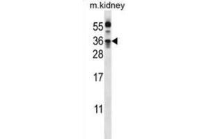 Western Blotting (WB) image for anti-Kallikrein 8 (KLK8) antibody (ABIN3002619) (Kallikrein 8 Antikörper)